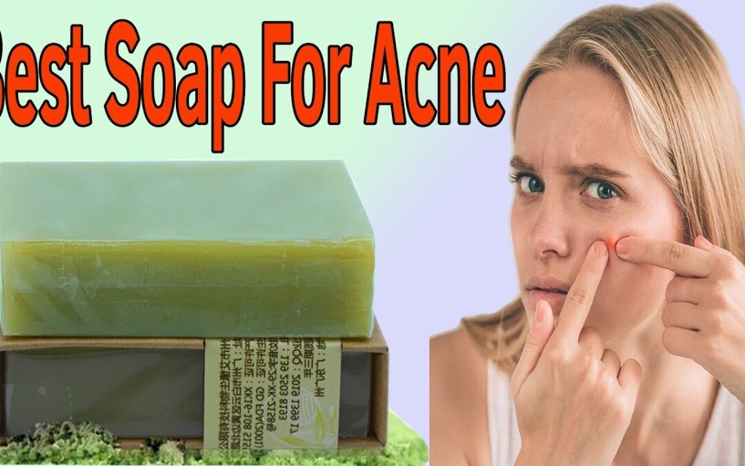 best soap for acne sulfur soap for acne dettol soap for acne dove soap for acne soap for acne